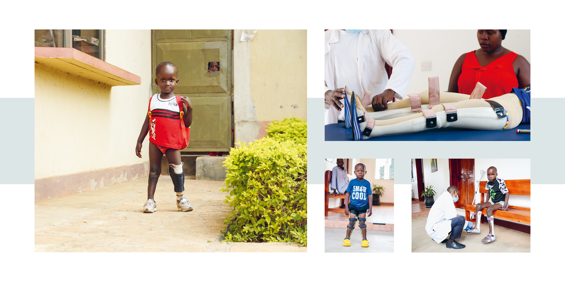 Pro Uganda – step by step into a life of dignity Child with a prosthetic leg walking outside a building; smaller images show a prosthetic leg fitting and a child with a prosthetic leg being assisted by a professional.
